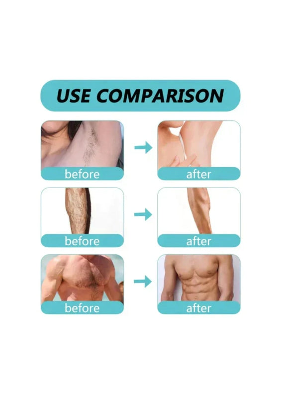 Ecrin hair removal spray