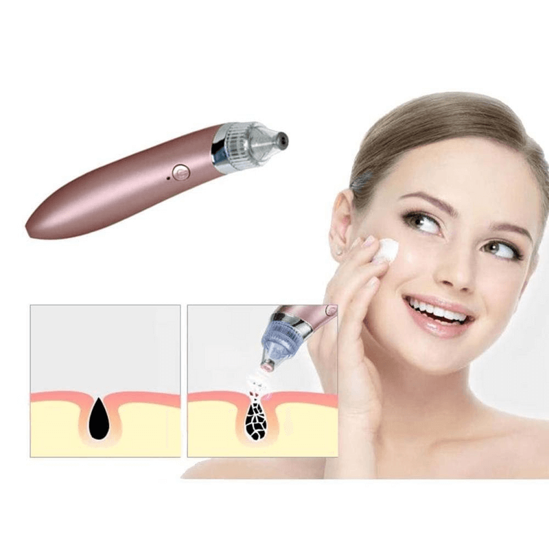 Blackhead remover- pore facial cleanser beauty machine