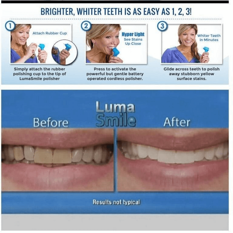 Dental teeth whitener- teeth stain remover