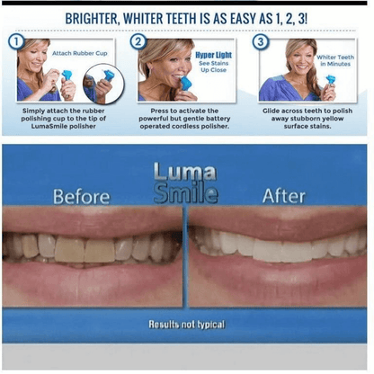 Dental teeth whitener- teeth stain remover