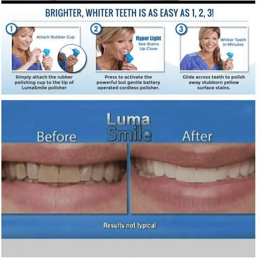 Dental teeth whitener- teeth stain remover