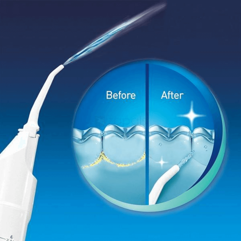 Power floss - air powered dental water jet
