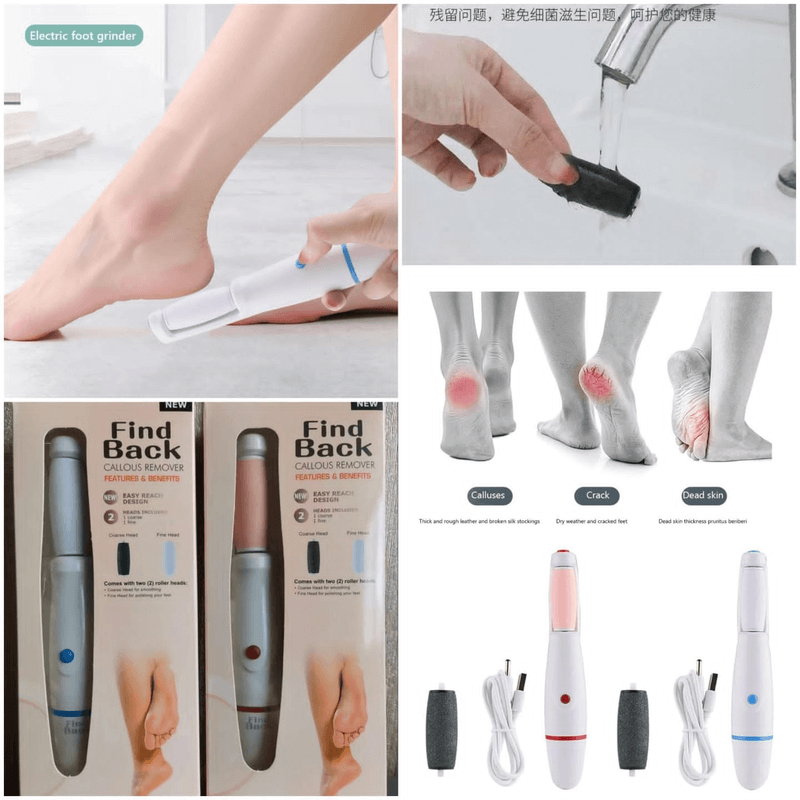 Find back callus remover