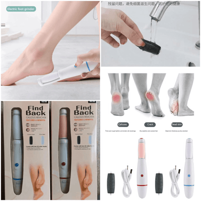 Find back callus remover
