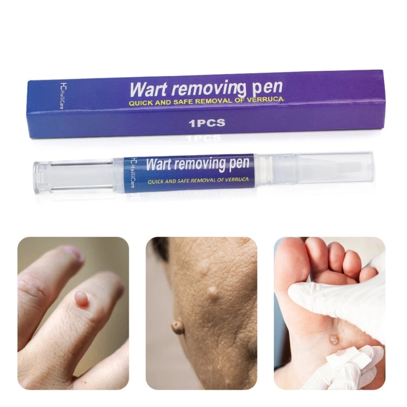 Warts Liquid Pen Woman Skin moles Remove Black Dots